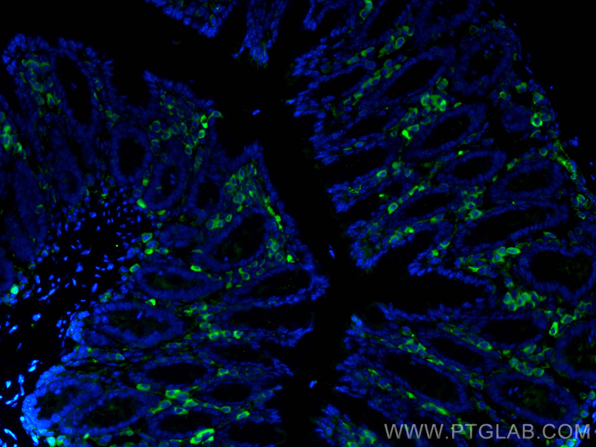 Immunofluorescence (IF) / fluorescent staining of mouse colon tissue using CD45 Monoclonal antibody (60287-1-Ig)