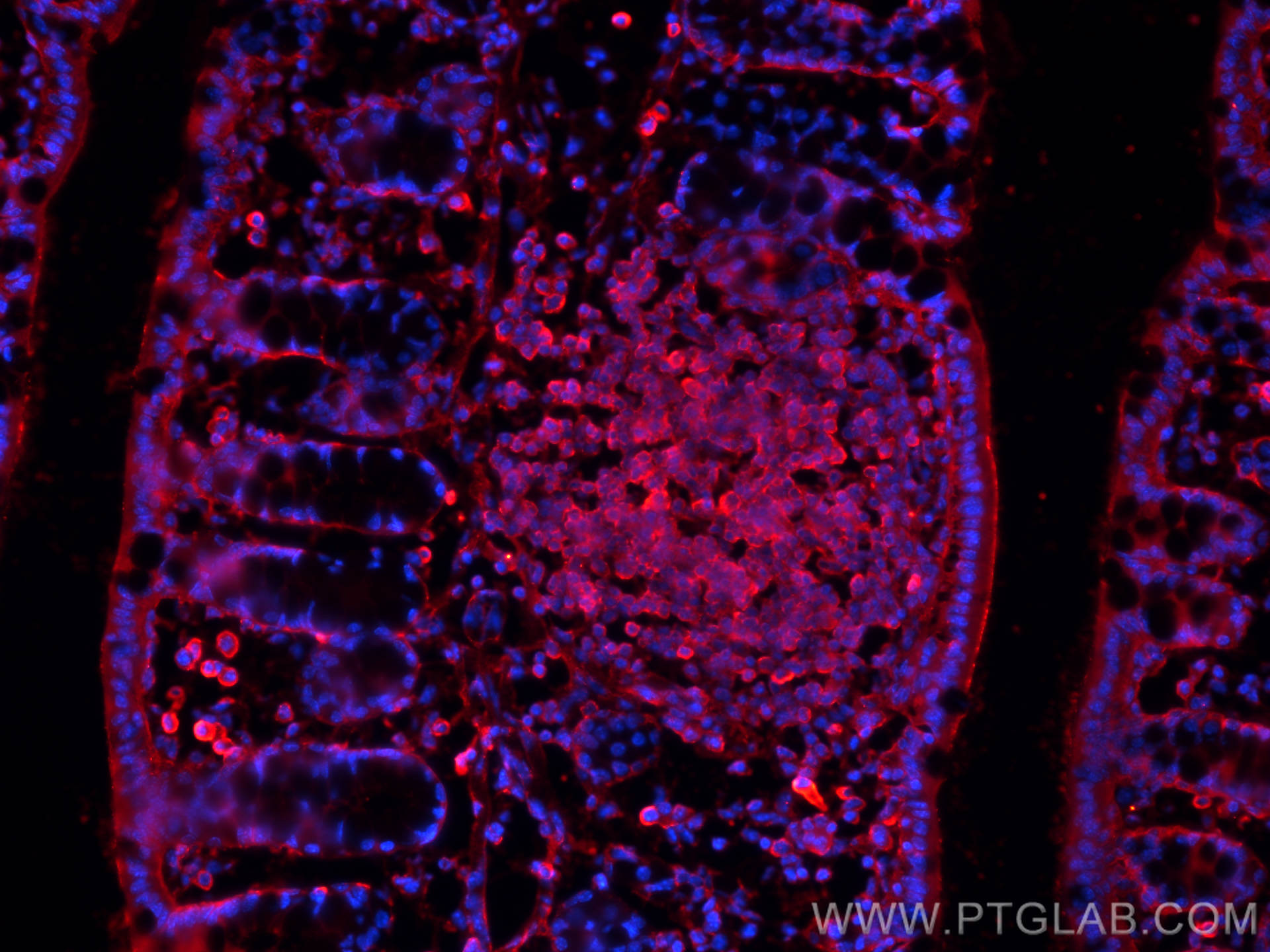 Immunofluorescence (IF) / fluorescent staining of mouse colon tissue using CD45 Monoclonal antibody (60287-1-Ig)