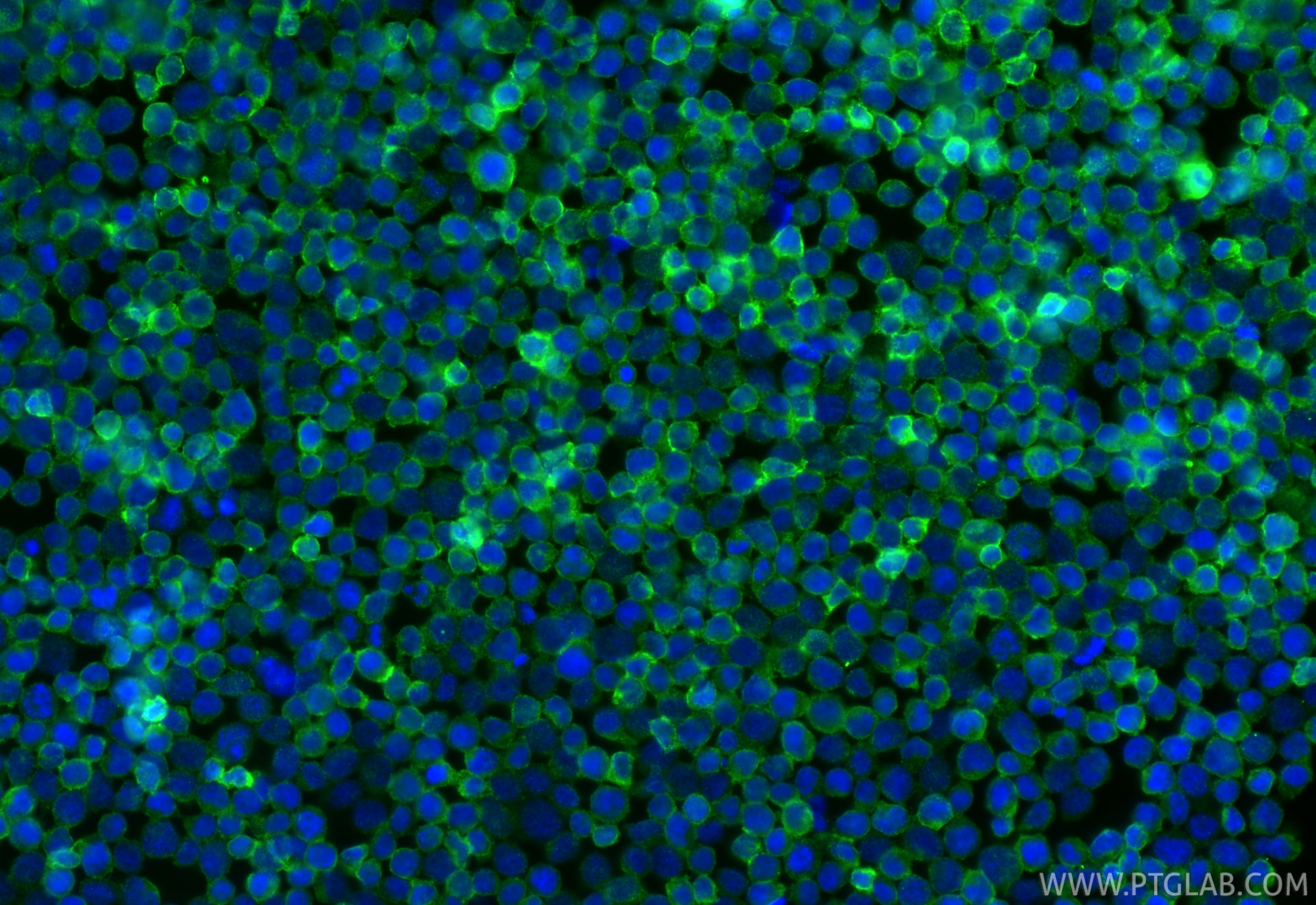 Immunofluorescence (IF) / fluorescent staining of Jurkat cells using CD45 Monoclonal antibody (60287-1-Ig)