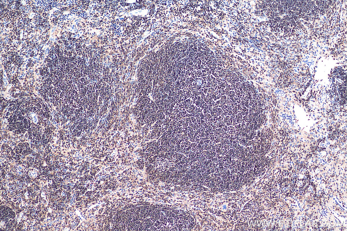 IHC staining of mouse spleen using 60287-1-Ig