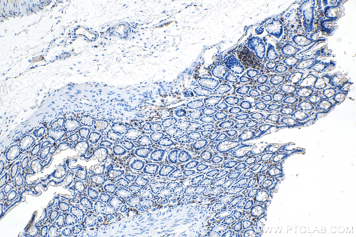 Immunohistochemistry (IHC) staining of rat colon tissue using CD45 Monoclonal antibody (60287-1-Ig)