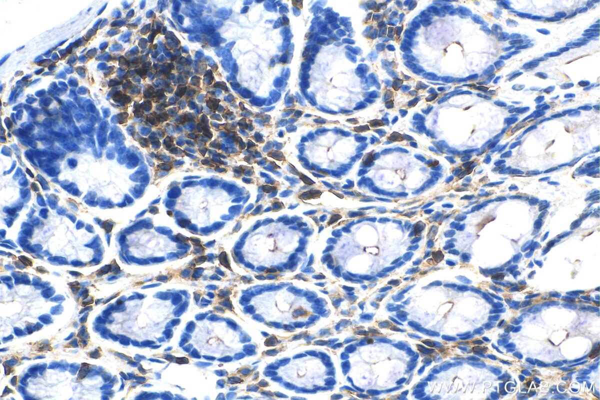 Immunohistochemistry (IHC) staining of rat colon tissue using CD45 Monoclonal antibody (60287-1-Ig)