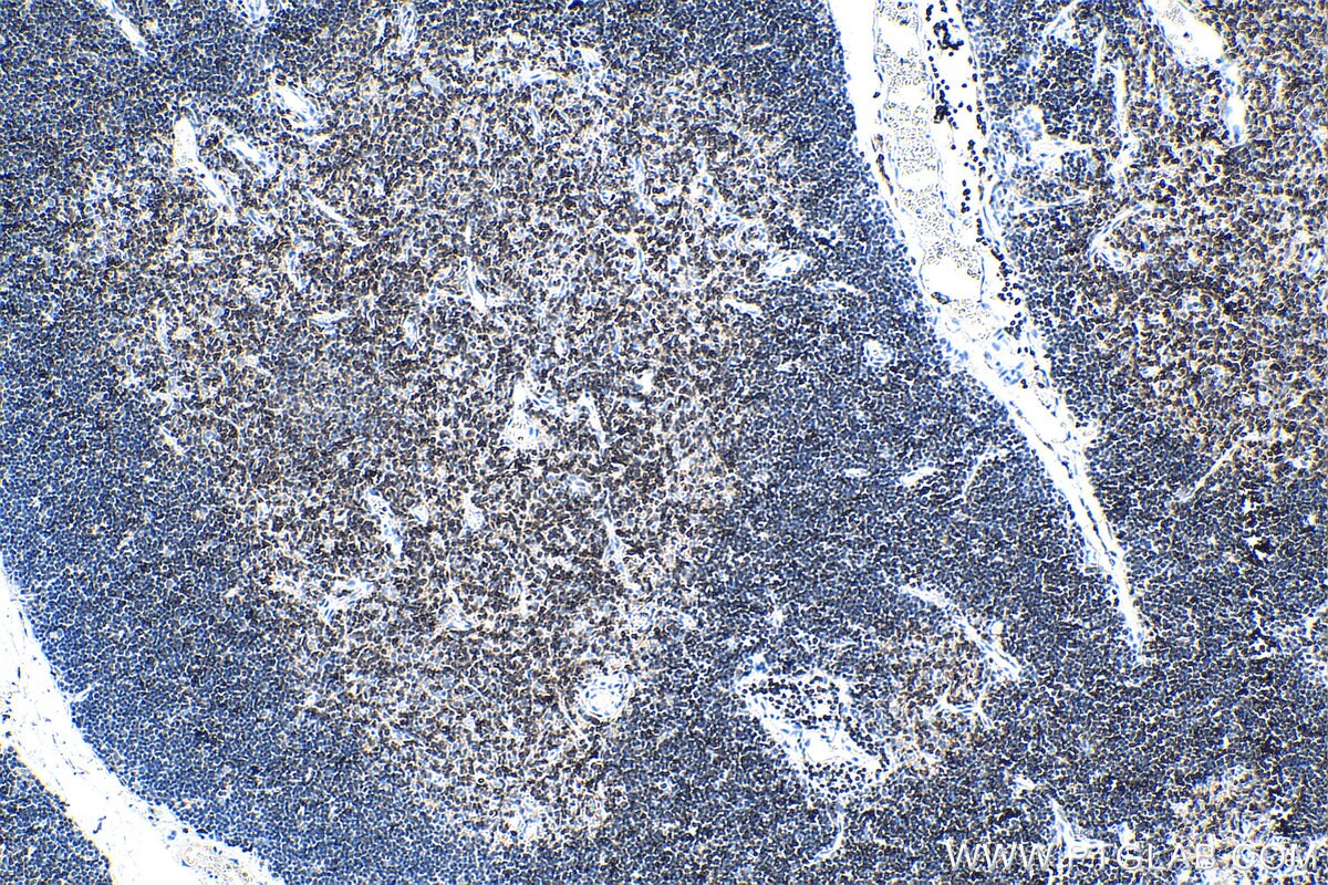 IHC staining of rat spleen using 60287-1-Ig