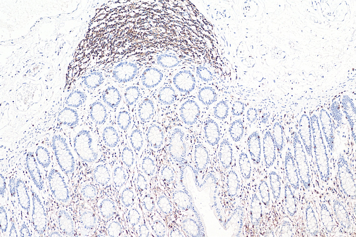Immunohistochemistry (IHC) staining of human colon tissue using CD45 Monoclonal antibody (60287-1-Ig)