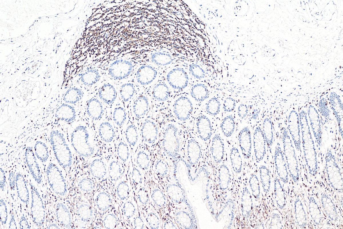 IHC staining of human colon using 60287-1-Ig