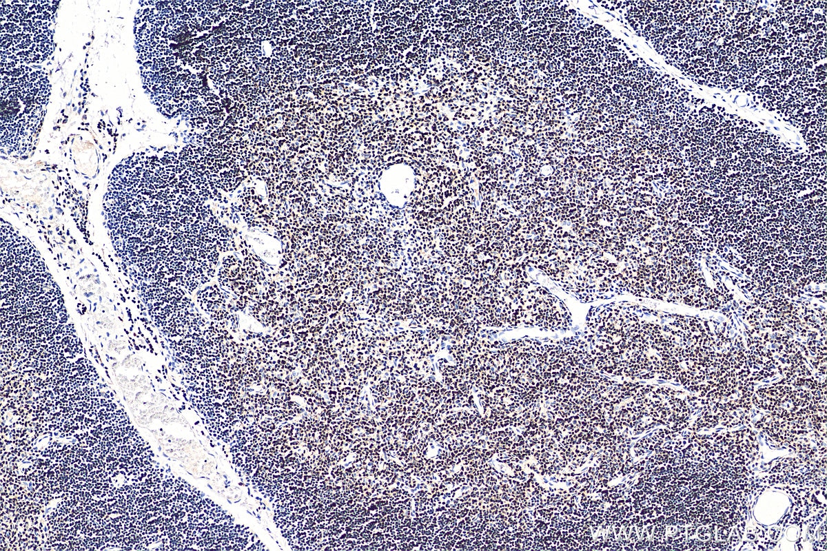 Immunohistochemistry (IHC) staining of rat thymus tissue using CD45 Monoclonal antibody (60287-1-Ig)