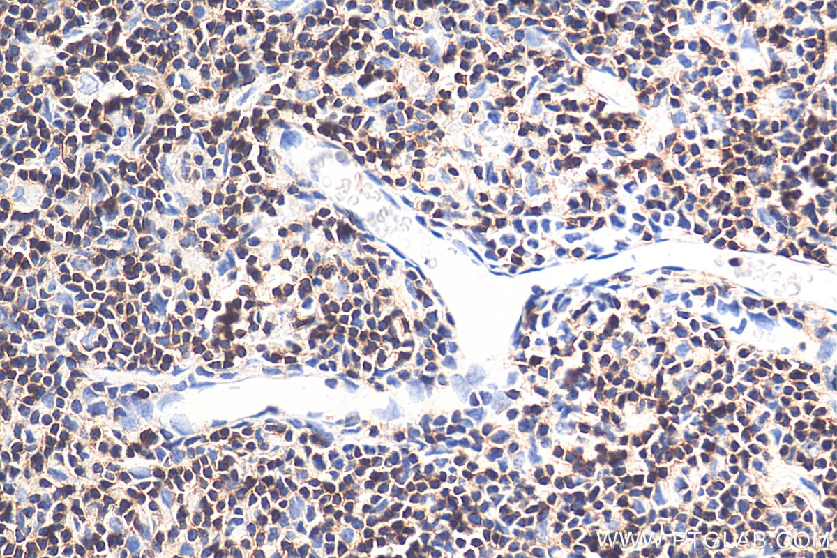 Immunohistochemistry (IHC) staining of rat thymus tissue using CD45 Monoclonal antibody (60287-1-Ig)