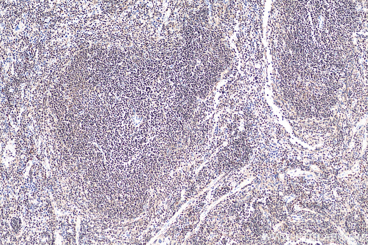 Immunohistochemistry (IHC) staining of mouse spleen tissue using CD45 Monoclonal antibody (60287-1-Ig)