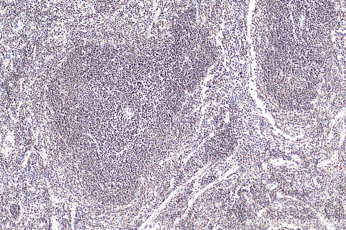 IHC staining of mouse spleen using 60287-1-Ig