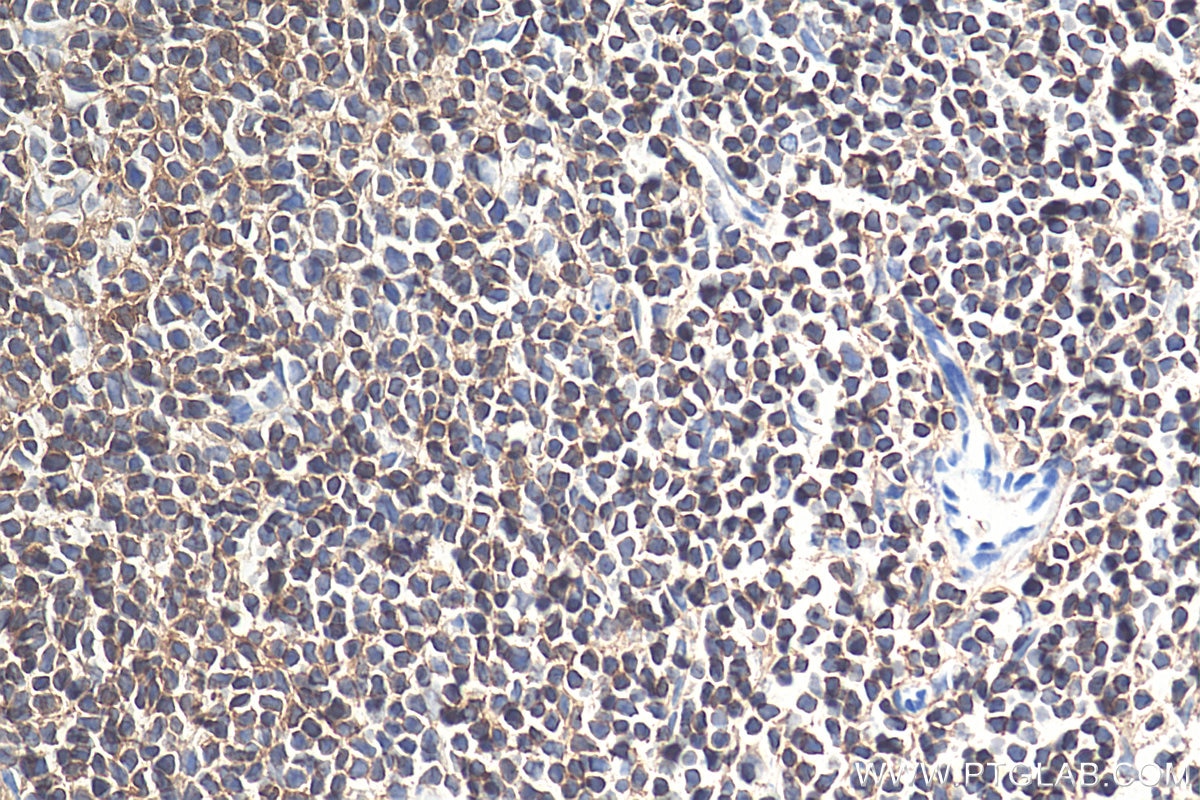 Immunohistochemistry (IHC) staining of mouse spleen tissue using CD45 Monoclonal antibody (60287-1-Ig)