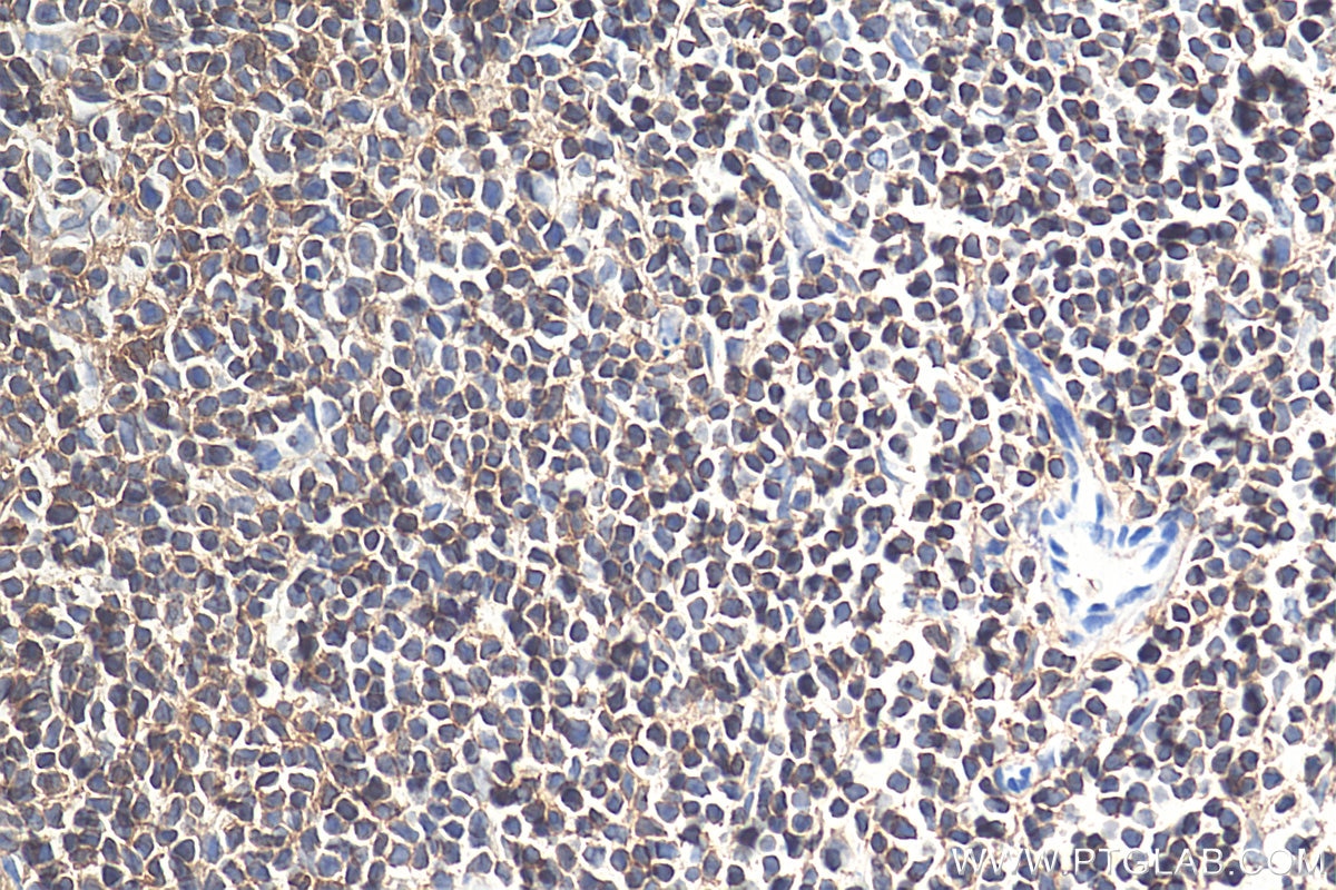 IHC staining of mouse spleen using 60287-1-Ig