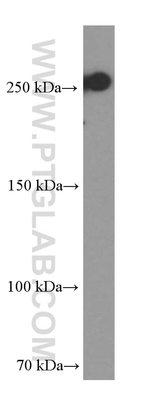 Western Blot (WB) analysis of Raji cells using CD45 Monoclonal antibody (60287-1-Ig)