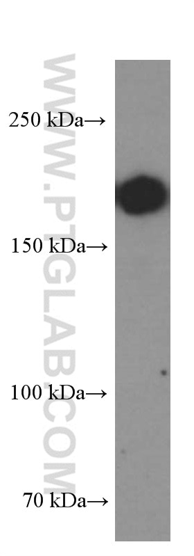 Western Blot (WB) analysis of pig spleen tissue using CD45 Monoclonal antibody (60287-1-Ig)