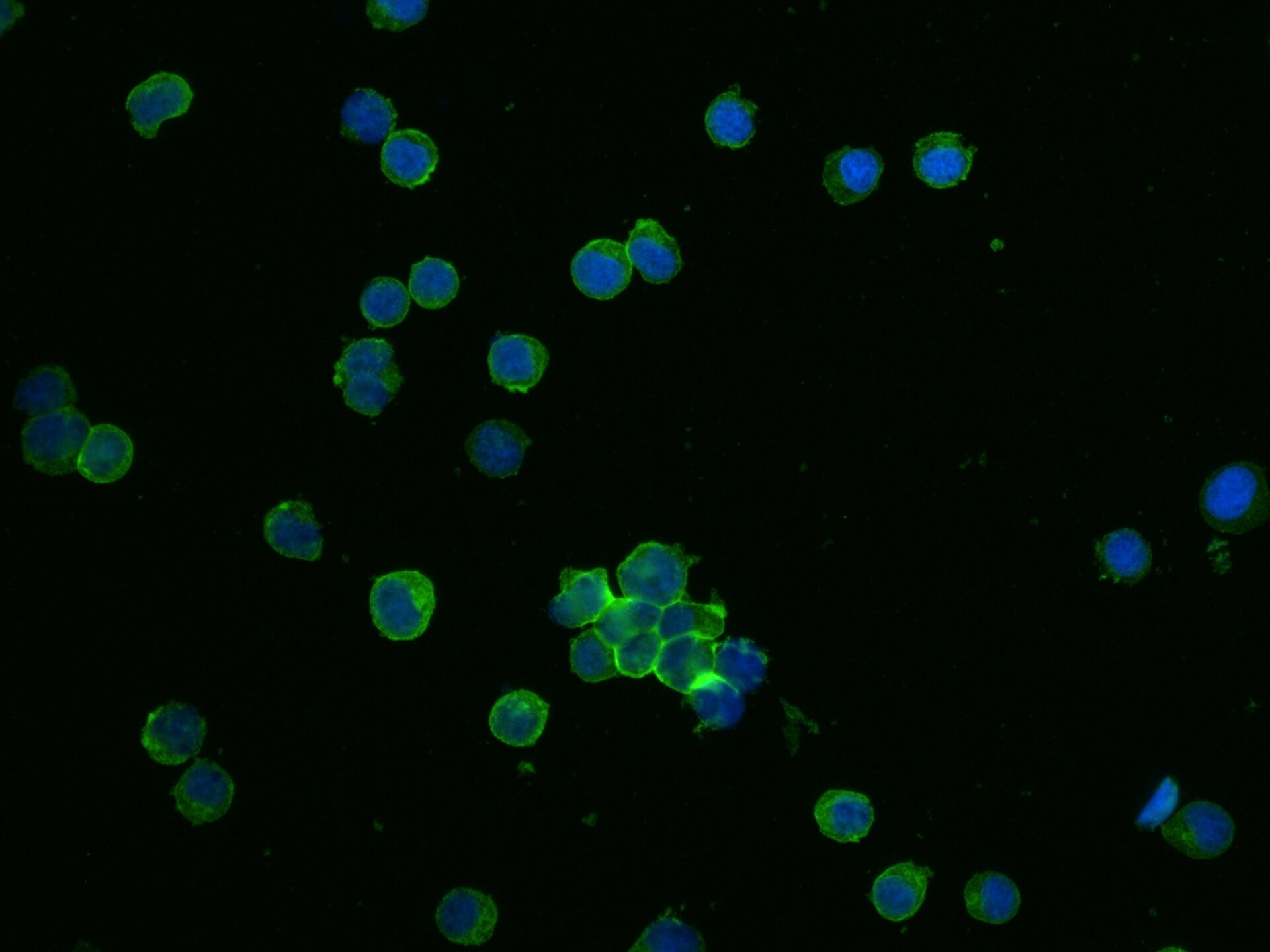 CD45