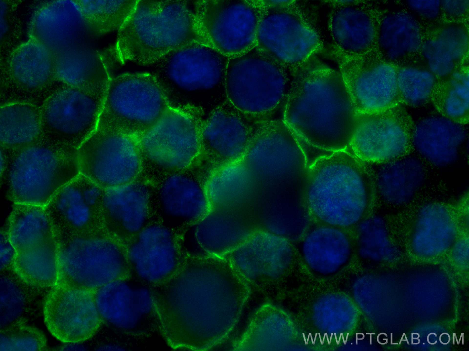 Immunofluorescence (IF) / fluorescent staining of Jurkat cells using Anti-Human CD45 (HI30) (65109-1-Ig)