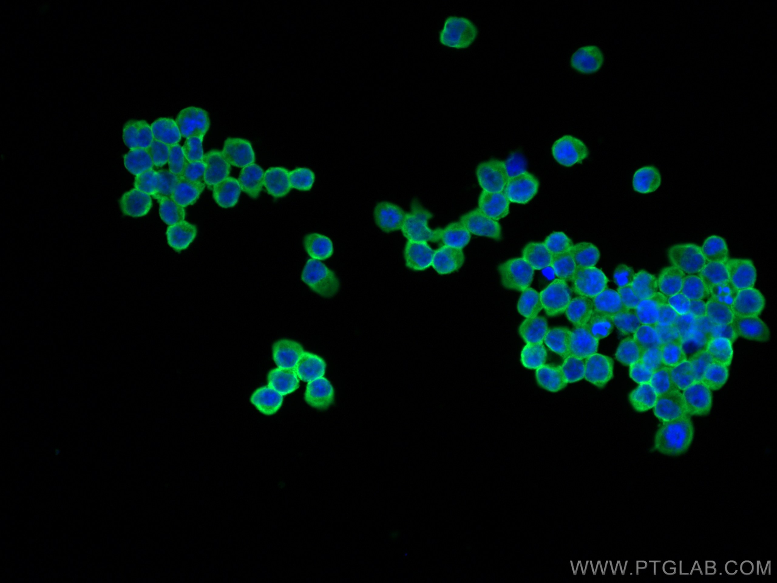 Immunofluorescence (IF) / fluorescent staining of Jurkat cells using CD45 Recombinant antibody (80297-1-RR)