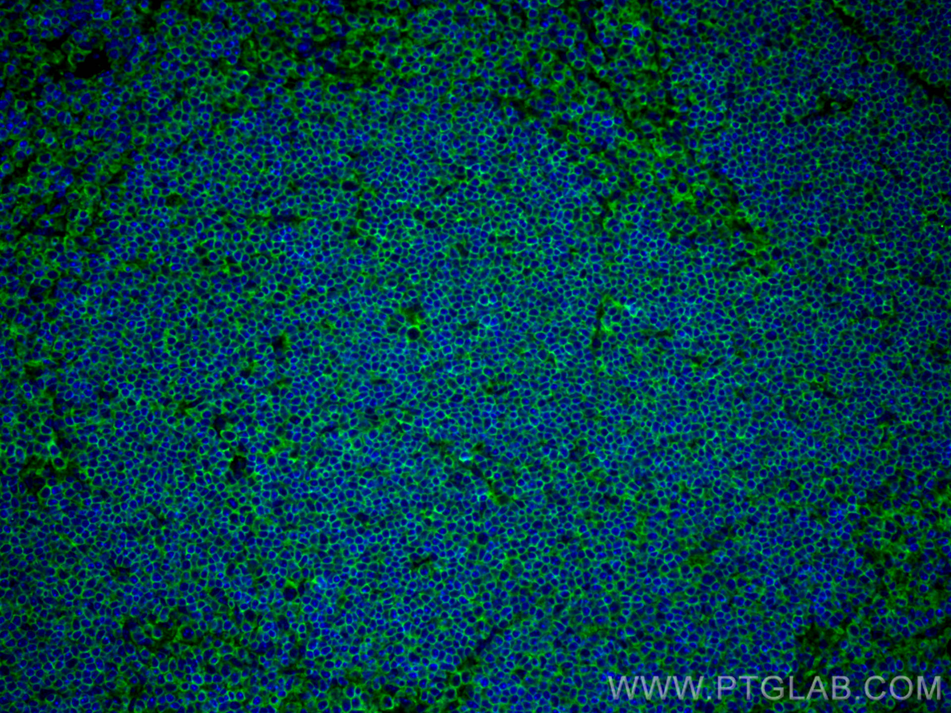 Immunofluorescence (IF) / fluorescent staining of mouse spleen tissue using CD45 Recombinant antibody (80297-1-RR)