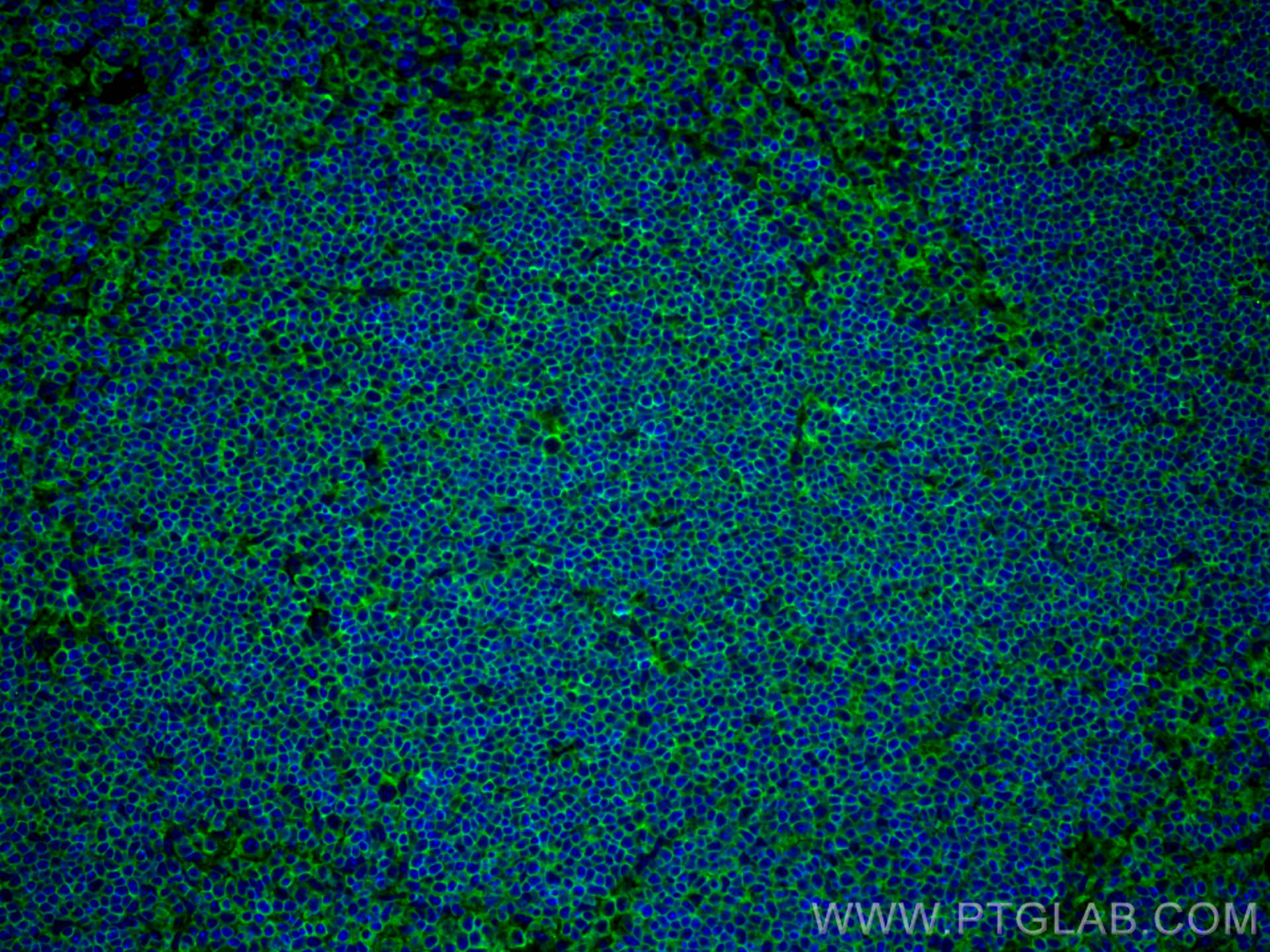 IF Staining of mouse spleen using 80297-1-RR