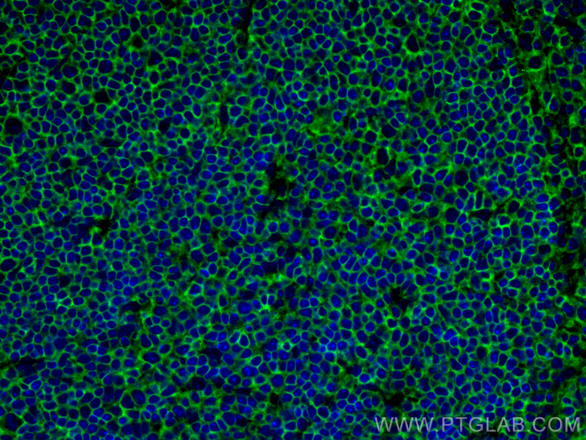 IF Staining of mouse spleen using 80297-1-RR