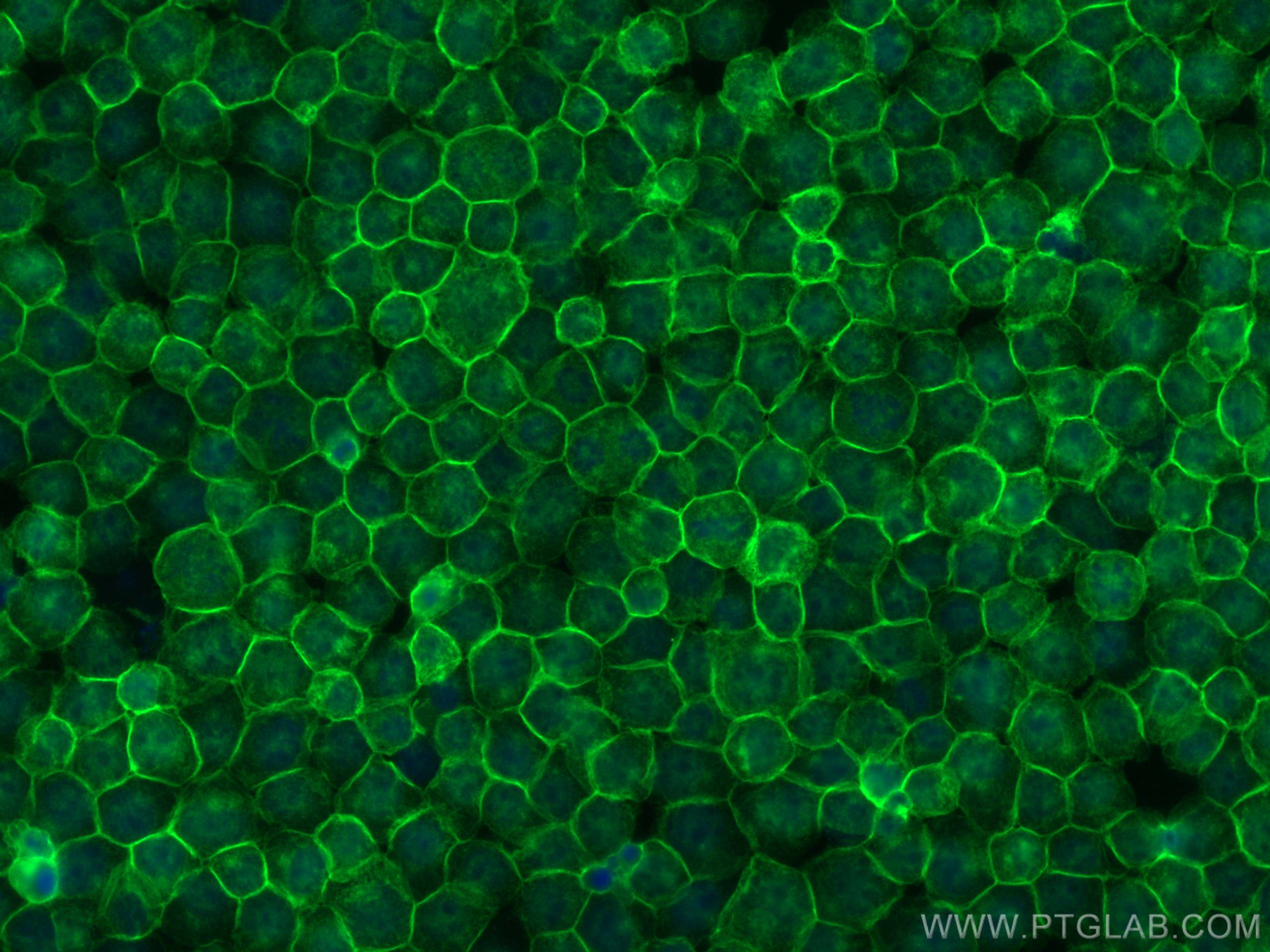 Immunofluorescence (IF) / fluorescent staining of Jurkat cells using CD45 Recombinant antibody (80297-1-RR)
