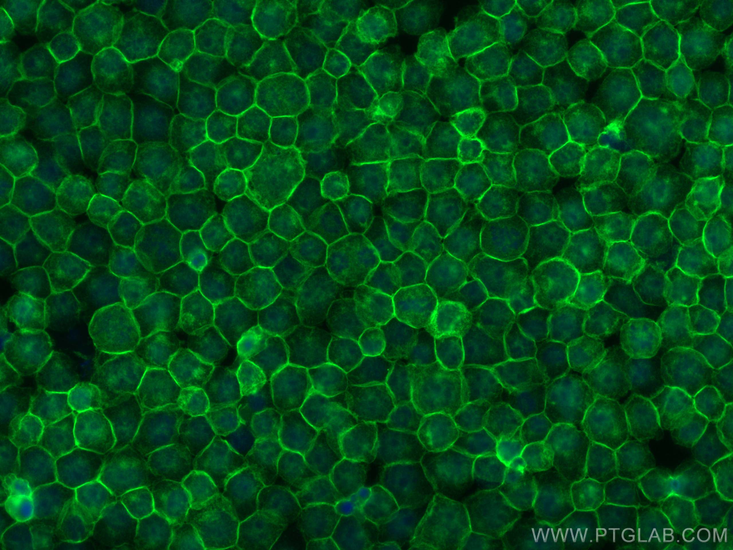 IF Staining of Jurkat using 80297-1-RR