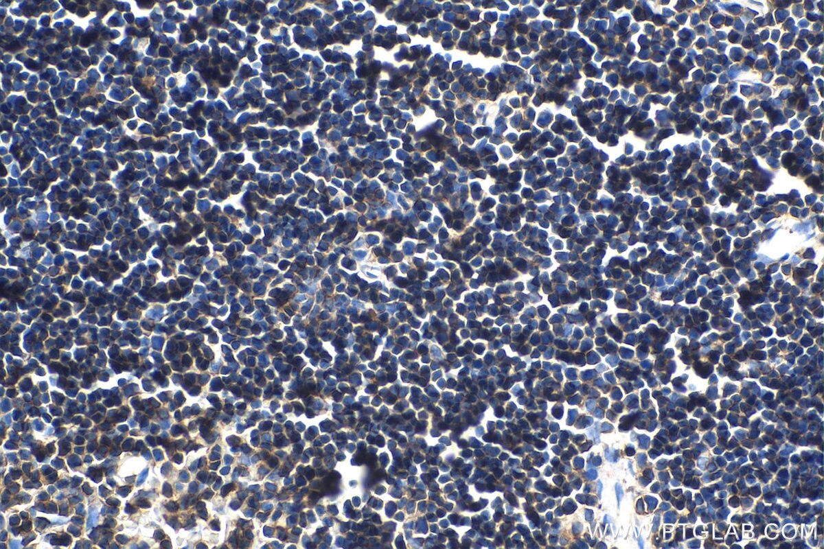CD45