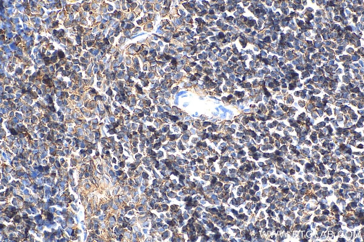 Immunohistochemistry (IHC) staining of mouse spleen tissue using CD45 Recombinant antibody (80297-1-RR)