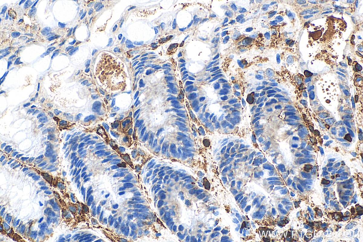 Immunohistochemistry (IHC) staining of mouse colon tissue using CD45 Recombinant antibody (80297-1-RR)