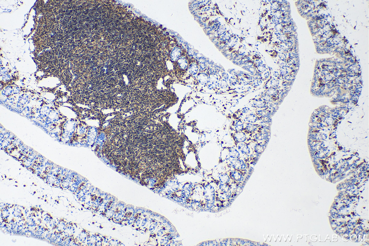 Immunohistochemistry (IHC) staining of mouse colon tissue using CD45 Recombinant antibody (80297-1-RR)