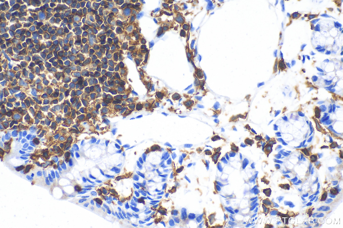 Immunohistochemistry (IHC) staining of mouse colon tissue using CD45 Recombinant antibody (80297-1-RR)