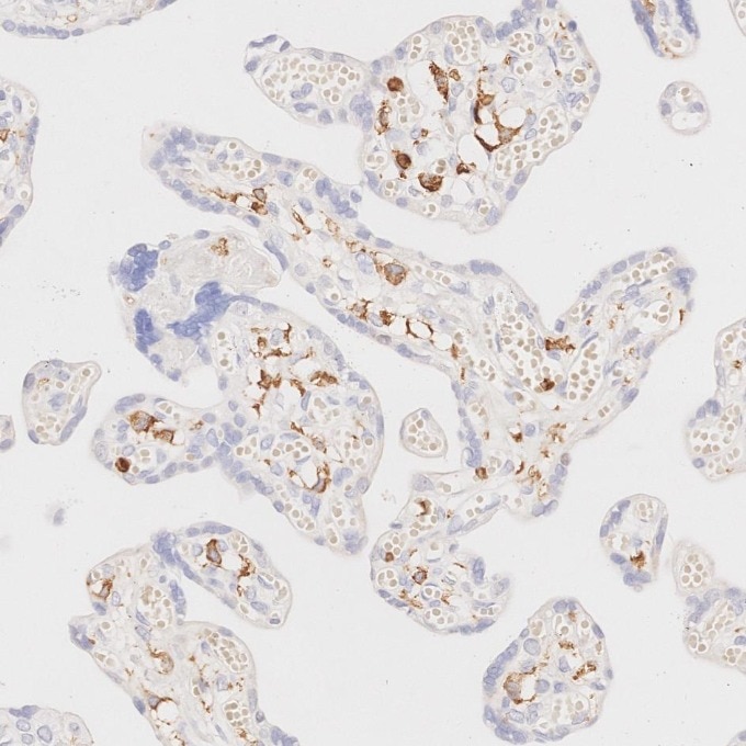 IHC staining of human placenta using 80297-1-RR Immunohistochemistry (IHC) staining of human placenta tissue using CD45 Recombinant monoclonal antibody (80297-1-RR)