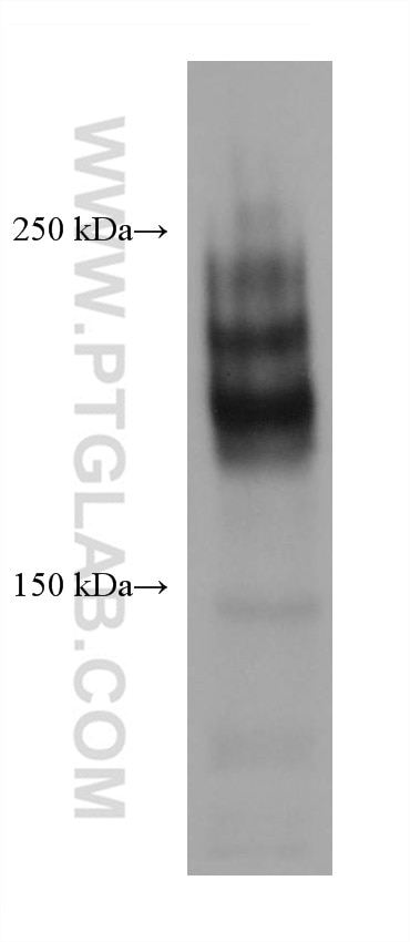 Western Blot (WB) analysis of Jurkat cells using CD45 Recombinant antibody (80297-1-RR)