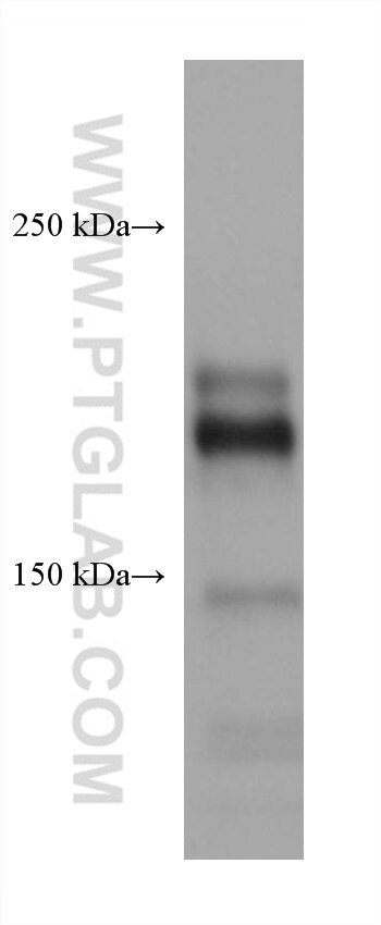 Western Blot (WB) analysis of K-562 cells using CD45 Recombinant antibody (80297-1-RR)
