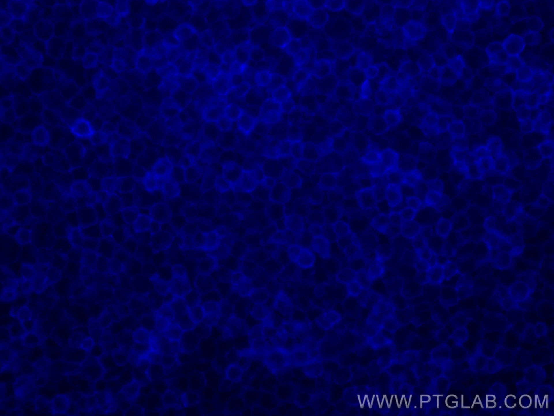 Immunofluorescence (IF) / fluorescent staining of Jurkat cells using FcZero-rAb™ CoraLite® Plus 405 Anti-Human CD45 Rab (CL405-FcA98117)