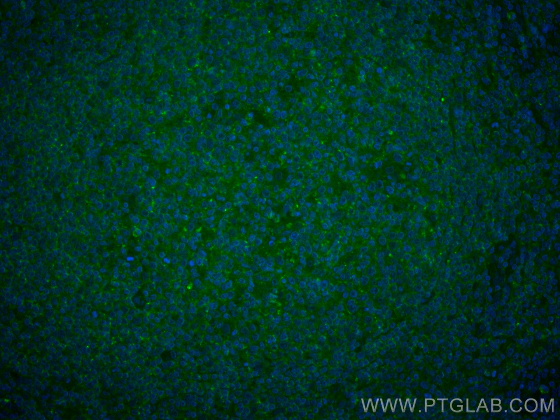Immunofluorescence (IF) / fluorescent staining of human tonsillitis tissue using CoraLite® Plus 488-conjugated CD45 Monoclonal anti (CL488-60287)