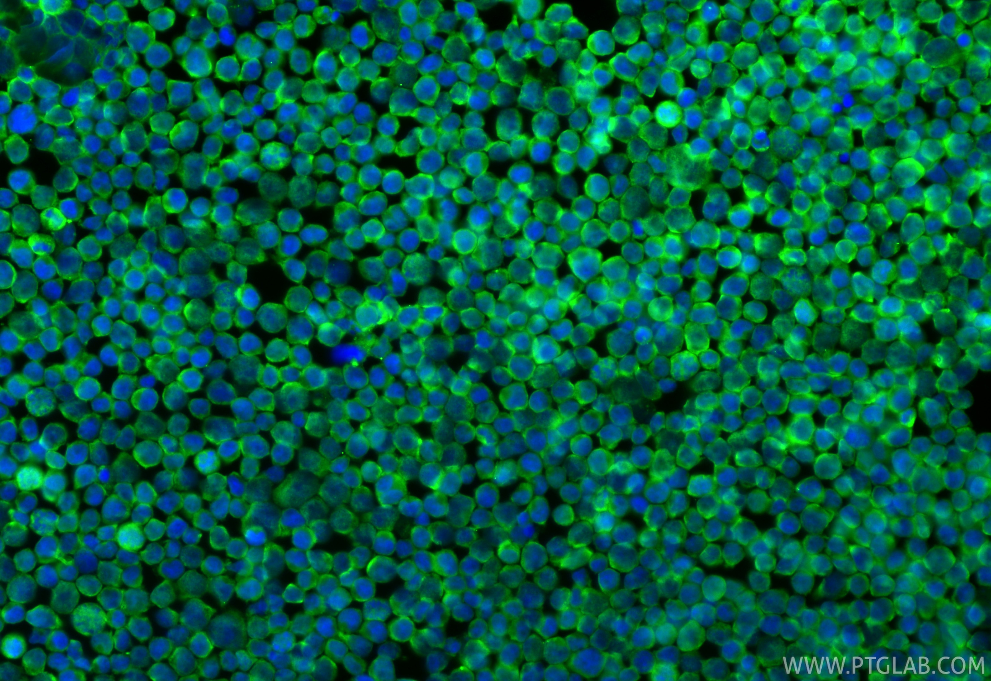 Immunofluorescence (IF) / fluorescent staining of Jurkat cells using CoraLite® Plus 488-conjugated CD45 Monoclonal anti (CL488-60287)