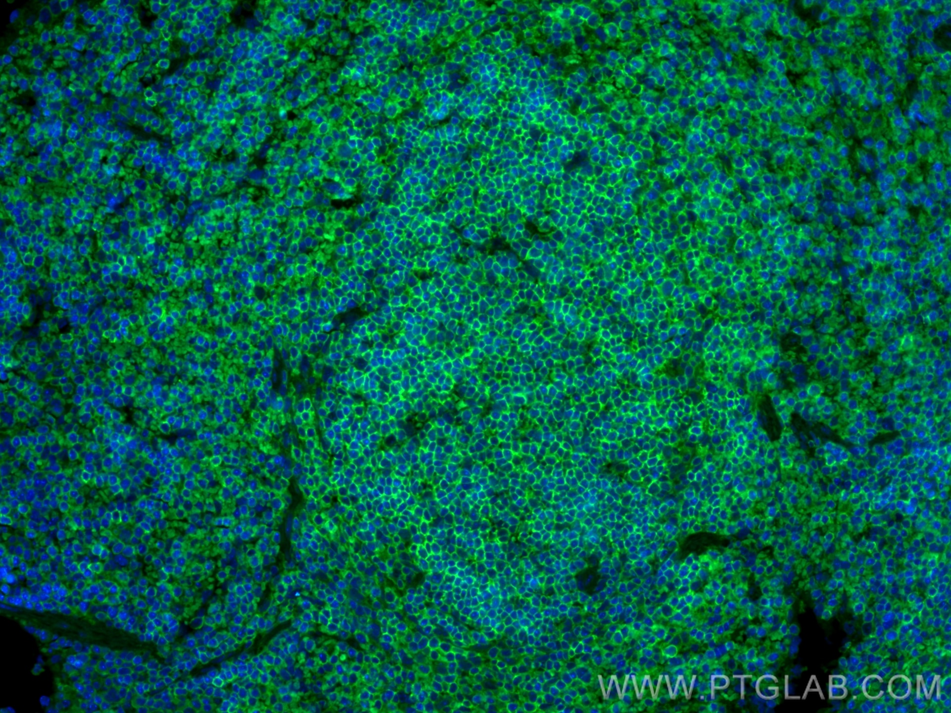 IF Staining of mouse spleen using CL488-80297
