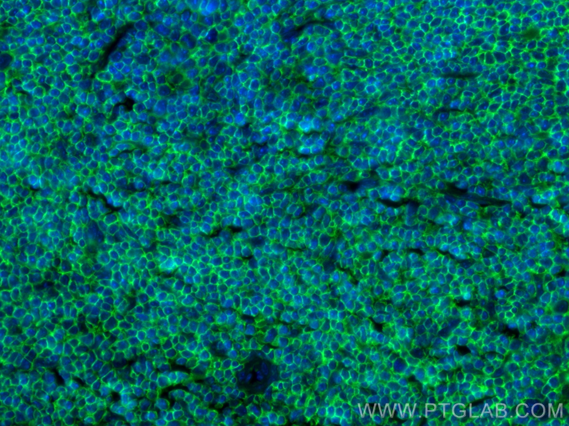 IF Staining of mouse spleen using CL488-80297