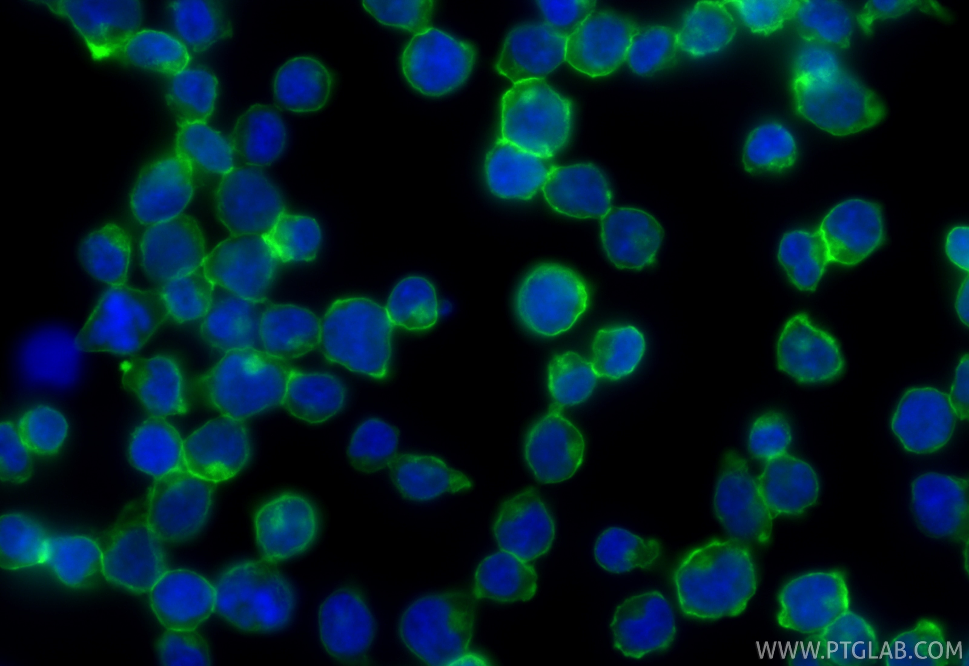 Immunofluorescent analysis of (4% PFA) fixed Jurkat cells using CoraLite® Plus 488 CD45 antibody (CL488-84405-6, Clone: 241670B6 ) at dilution of 1:200. Immunofluorescence (IF) / fluorescent staining of Jurkat cells using CoraLite® Plus 488-conjugated CD45 Recombinant mon (CL488-84405-6)