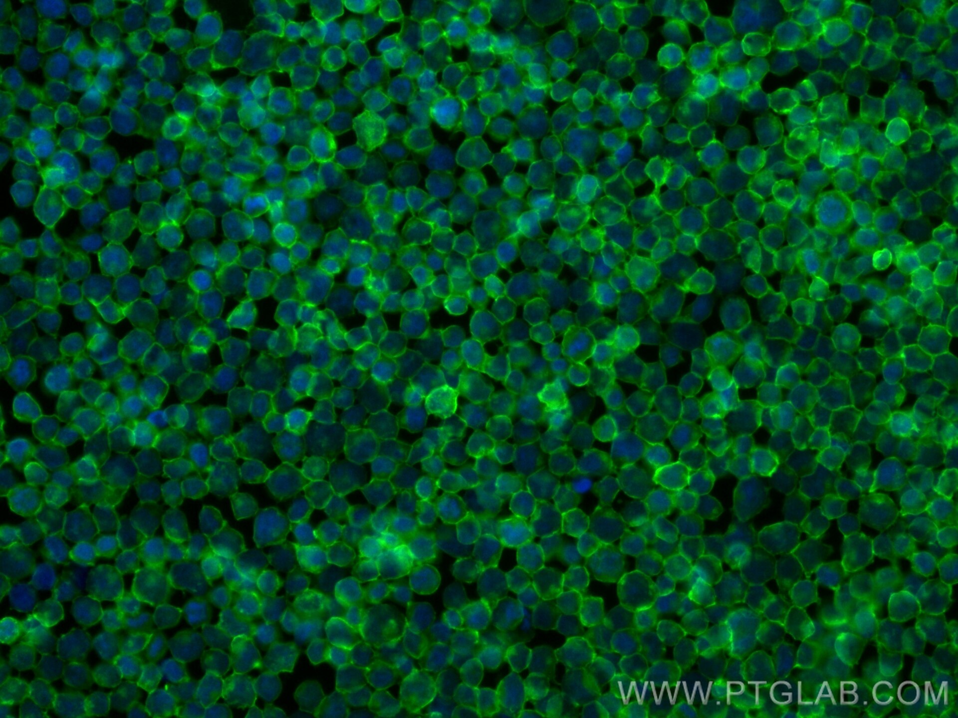 Immunofluorescence (IF) / fluorescent staining of Jurkat cells using FcZero-rAb™ CoraLite® Plus 488 Anti-Human CD45 Rab (CL488-FcA98117)