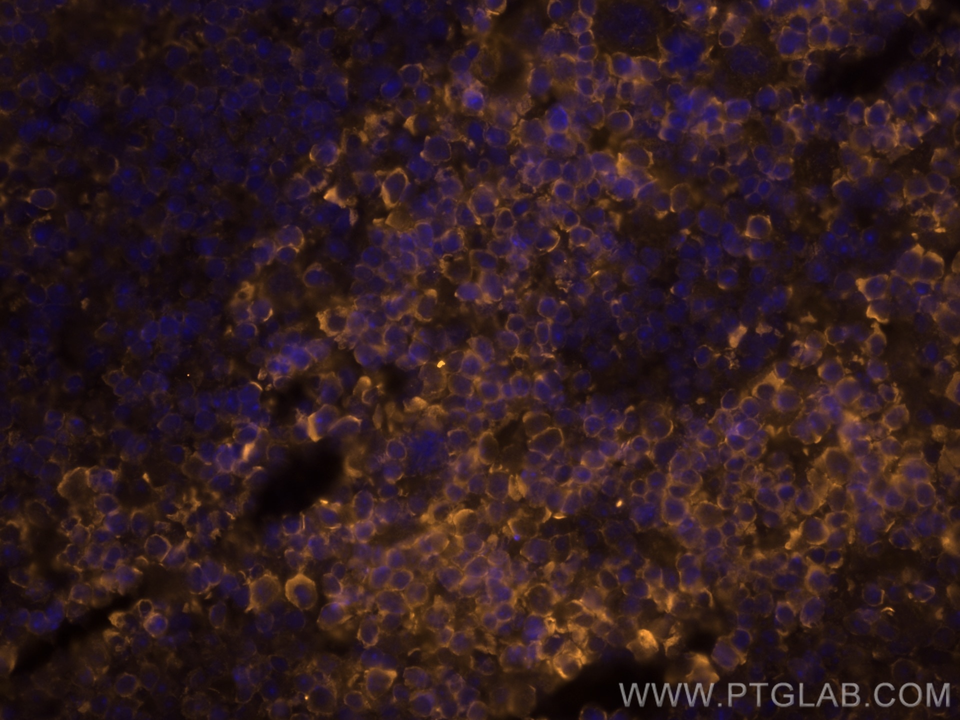 Immunofluorescence (IF) / fluorescent staining of mouse spleen tissue using CoraLite®555-conjugated CD45 Monoclonal antibody (CL555-60287)