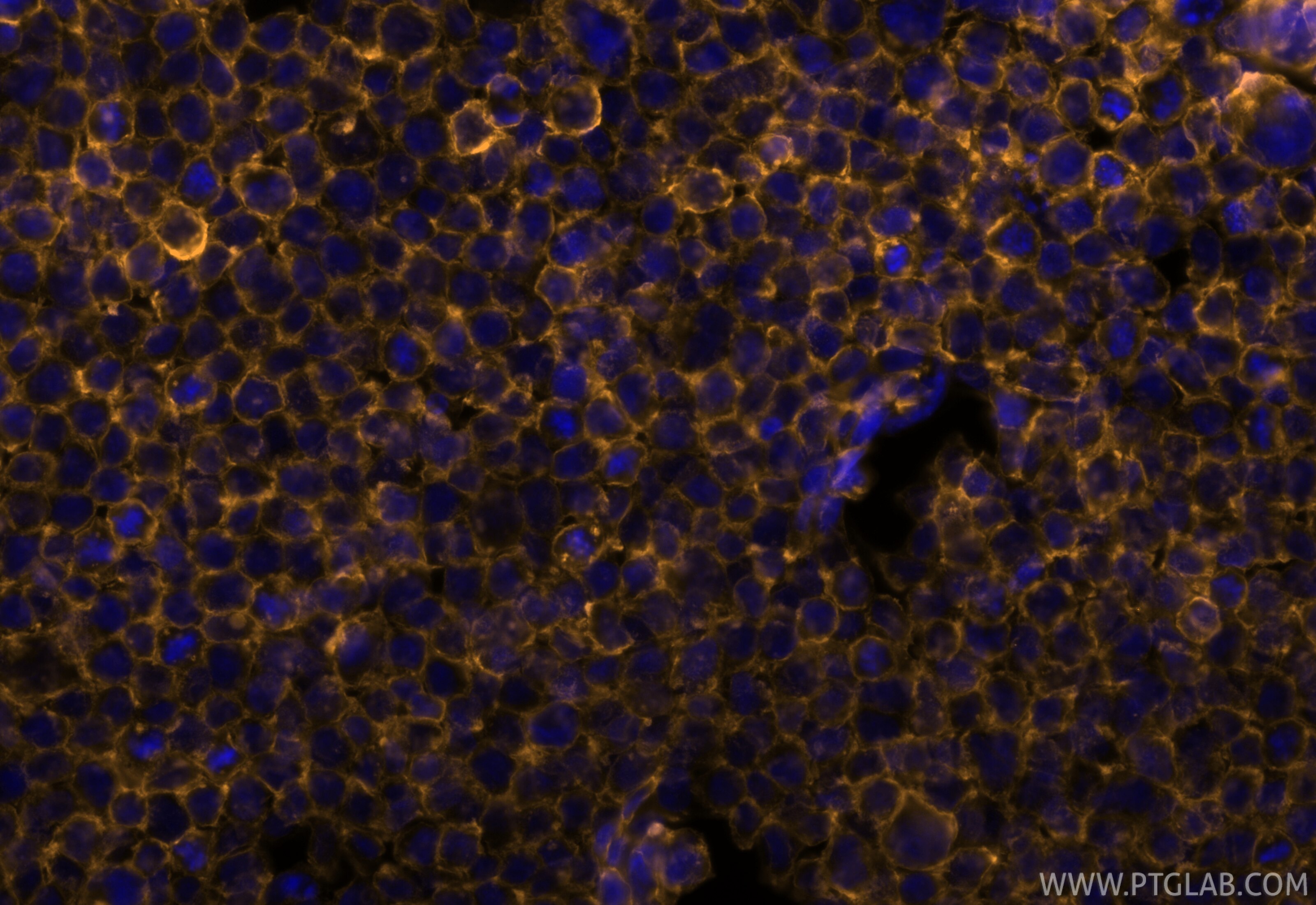Immunofluorescence (IF) / fluorescent staining of THP-1 cells using CoraLite® Plus 555 Anti-Human CD45 (HI30) (CL555-65109)