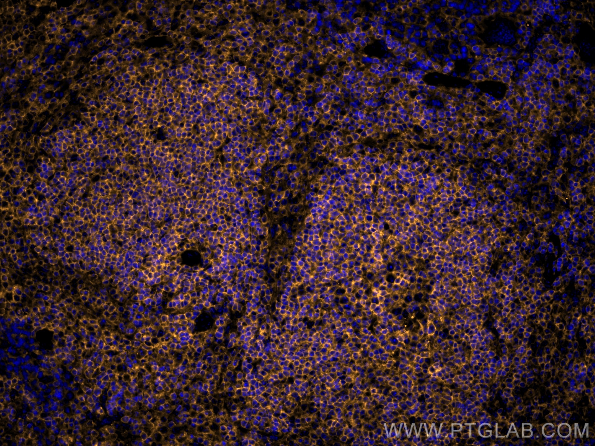 Immunofluorescence (IF) / fluorescent staining of mouse spleen tissue using CoraLite®555-conjugated CD45 Recombinant antibody (CL555-80297)