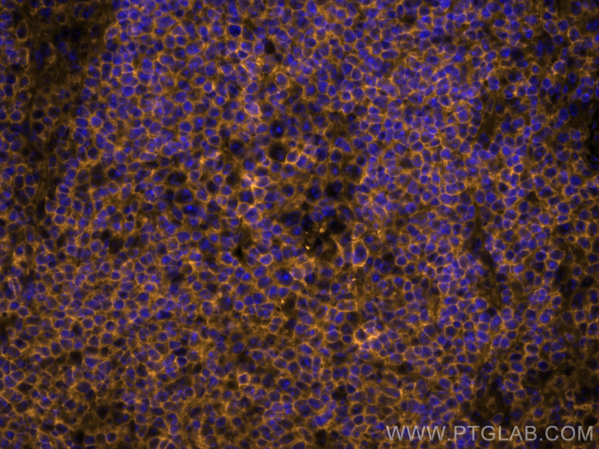 Immunofluorescence (IF) / fluorescent staining of mouse spleen tissue using CoraLite®555-conjugated CD45 Recombinant antibody (CL555-80297)