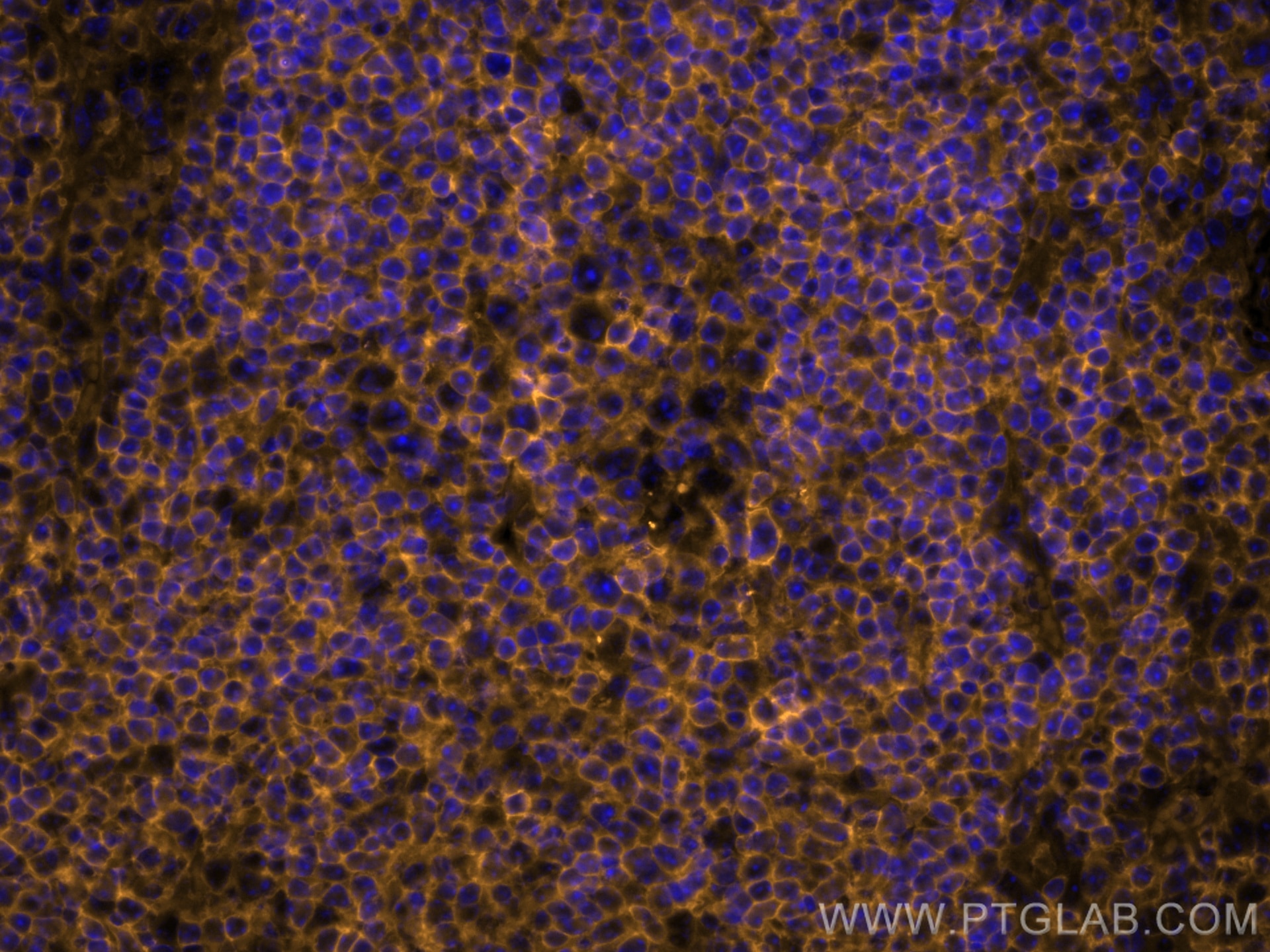 IF Staining of mouse spleen using CL555-80297