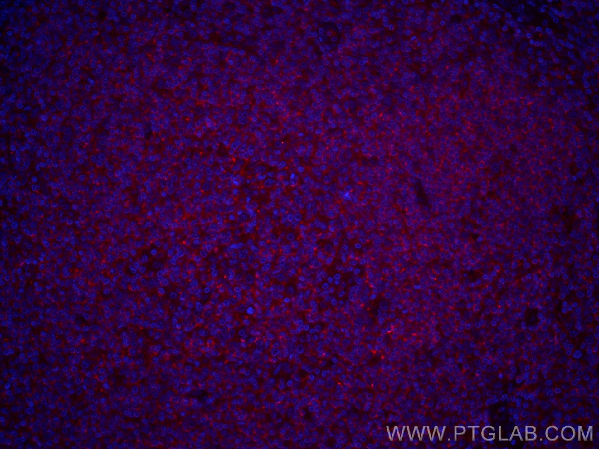 Immunofluorescence (IF) / fluorescent staining of human tonsillitis tissue using CoraLite®594-conjugated CD45 Monoclonal antibody (CL594-60287)