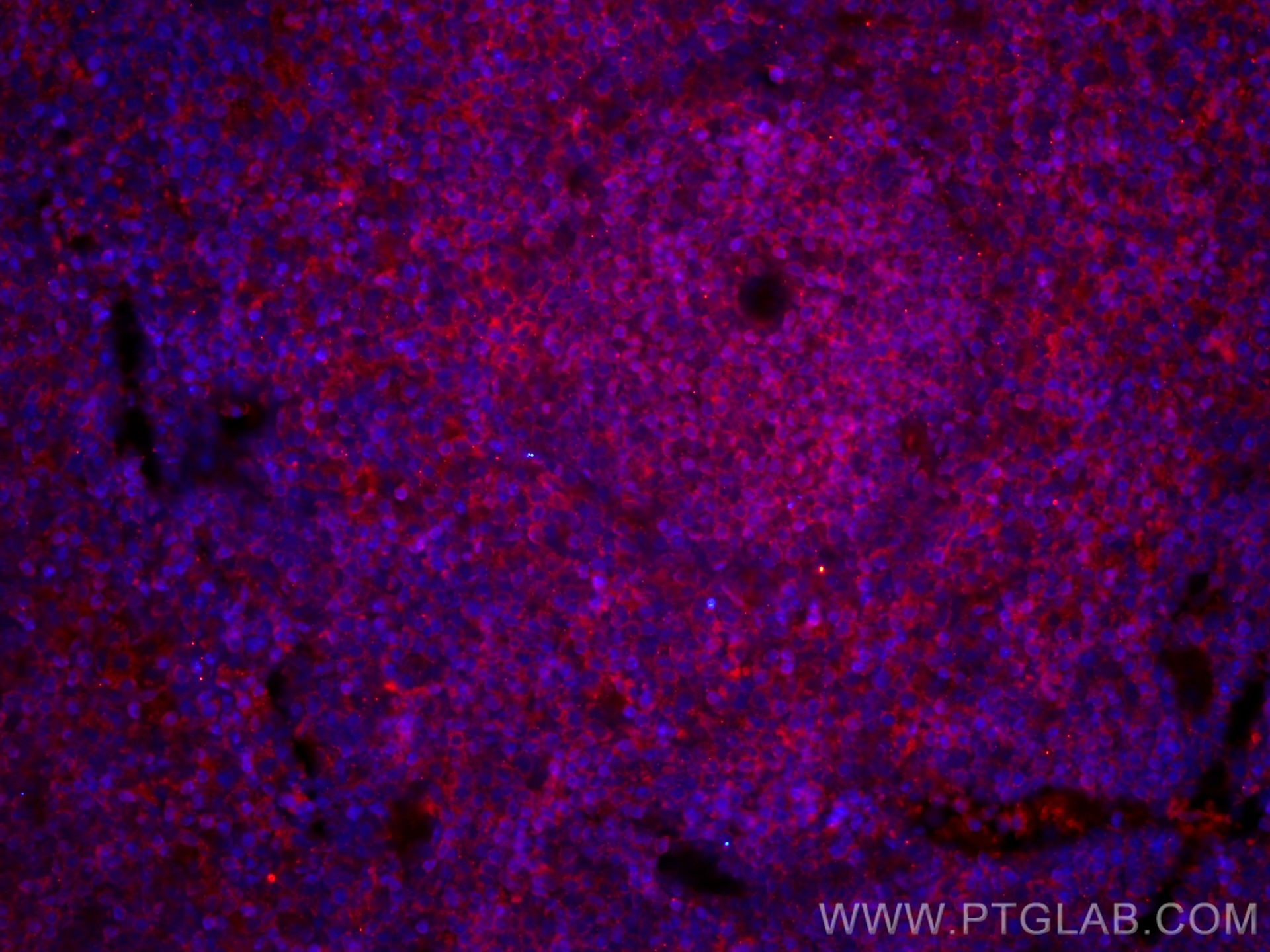 Immunofluorescence (IF) / fluorescent staining of mouse spleen tissue using CoraLite®594-conjugated CD45 Monoclonal antibody (CL594-60287)