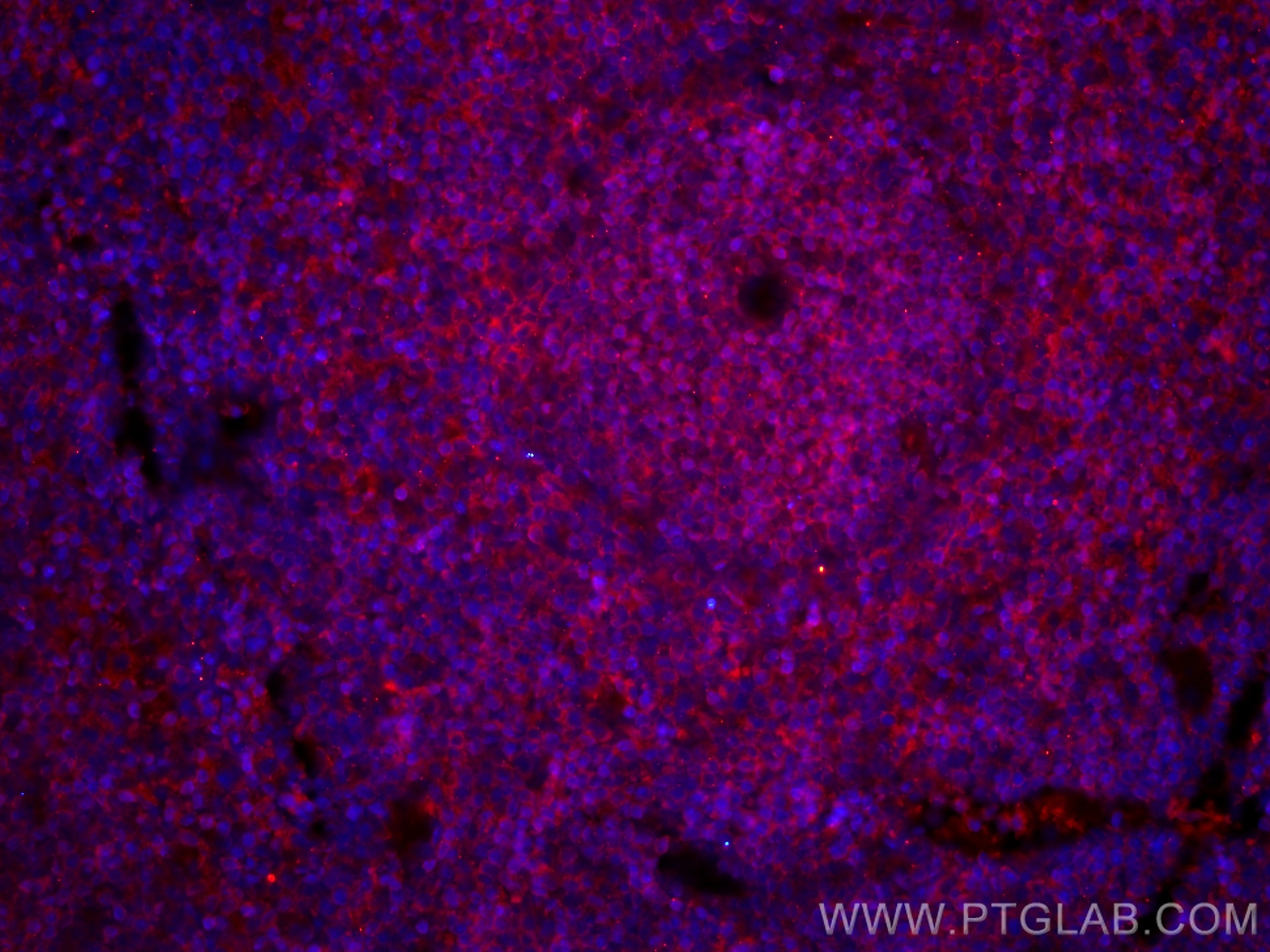 IF Staining of mouse spleen using CL594-60287