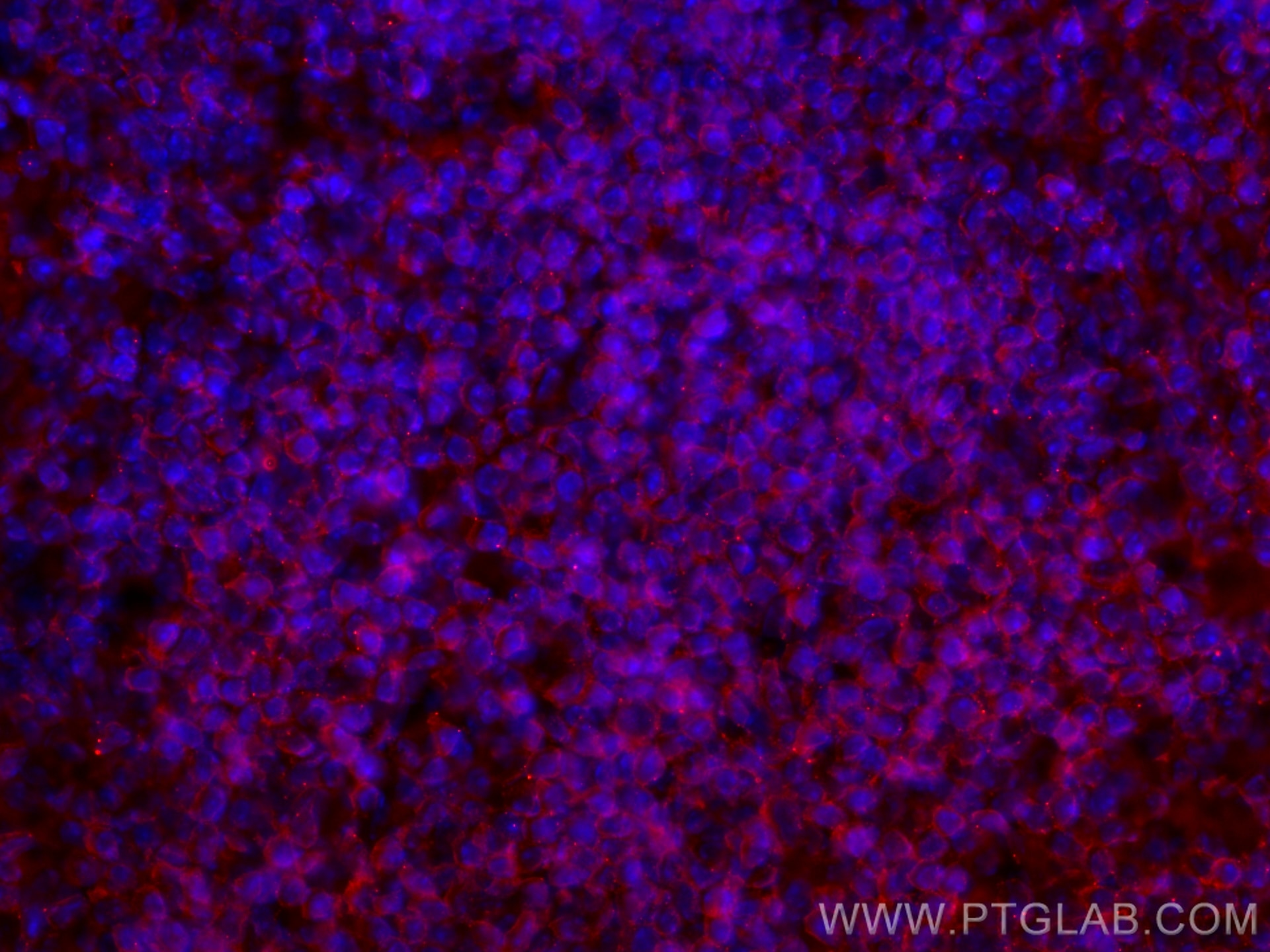 Immunofluorescence (IF) / fluorescent staining of mouse spleen tissue using CoraLite®594-conjugated CD45 Monoclonal antibody (CL594-60287)