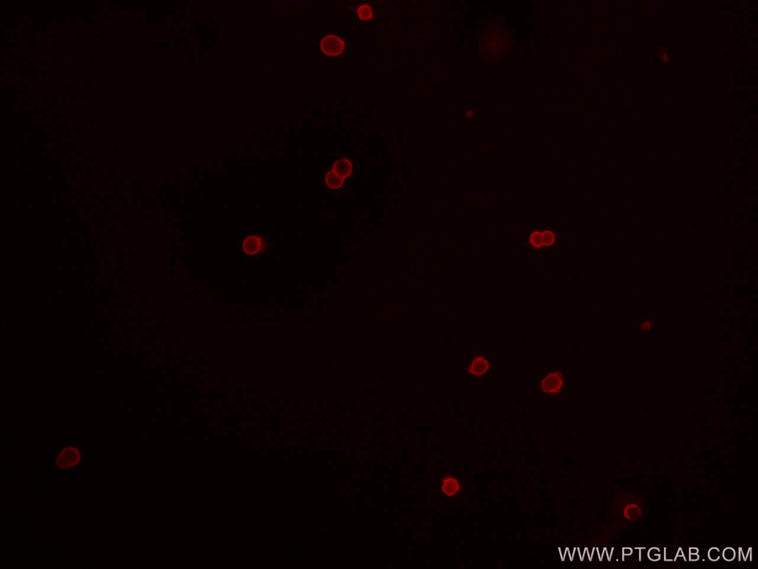 IF Staining of mouse splenocytes using CL647-65087